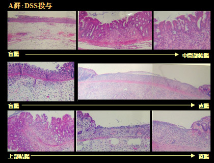 写真５：Ａ群の大腸の組織学的所見