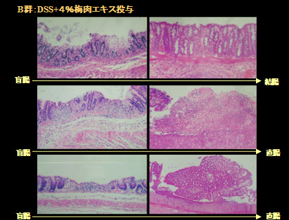 写真６：Ｂ群の大腸の組織学的所見